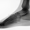 Wilk-PTI-Online-Anatomy-Of-The-Foot-And-Ankle-Complex-By-David-Nolan-free-download