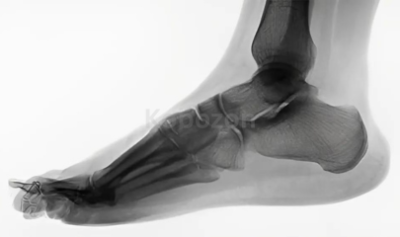 Wilk-PTI-Online-Anatomy-Of-The-Foot-And-Ankle-Complex-By-David-Nolan-free-download