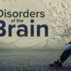 Understanding-Disorders-of-the-Brain-By-Sandy-Neargarder-free-download